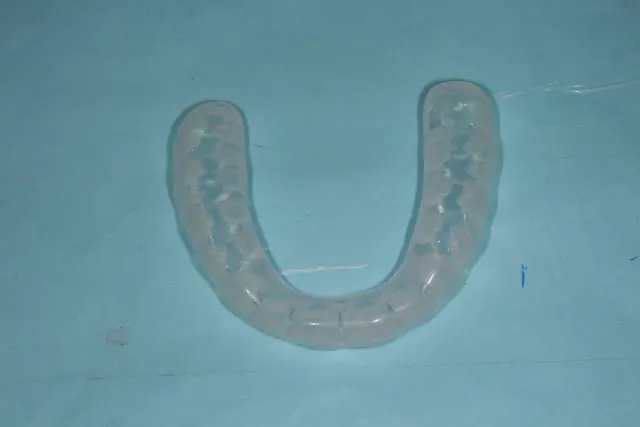 前診所製作的軟式咬合板（咬合面）