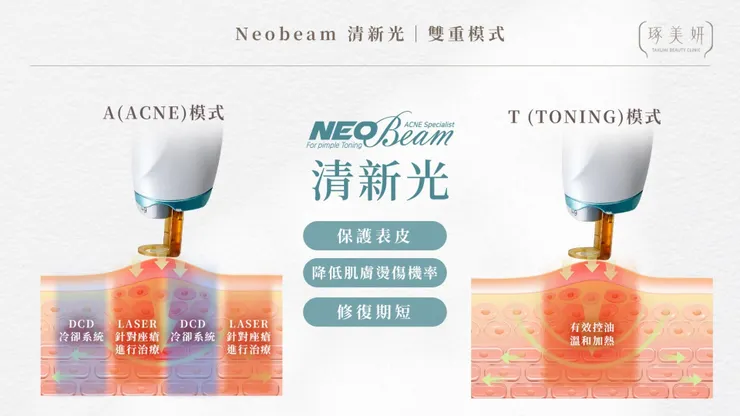 【控油新境界】油光滿面怎麼辦？Neobeam 清新光：從根源縮小皮脂腺的黑科技
