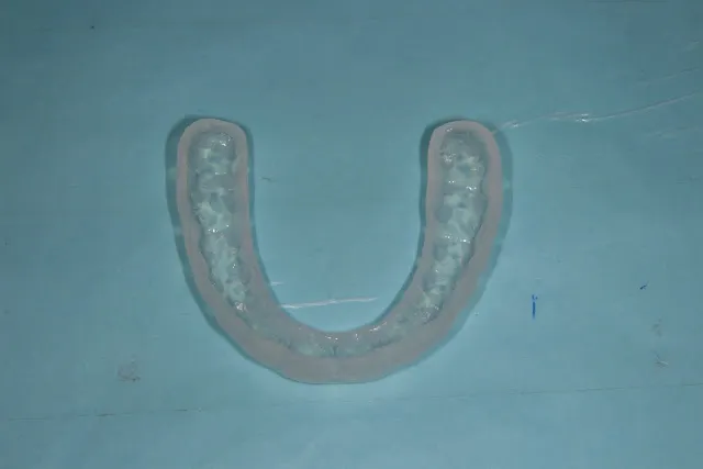 前診所製作的軟式咬合板，3.41mm，很耐磨吧（內面）