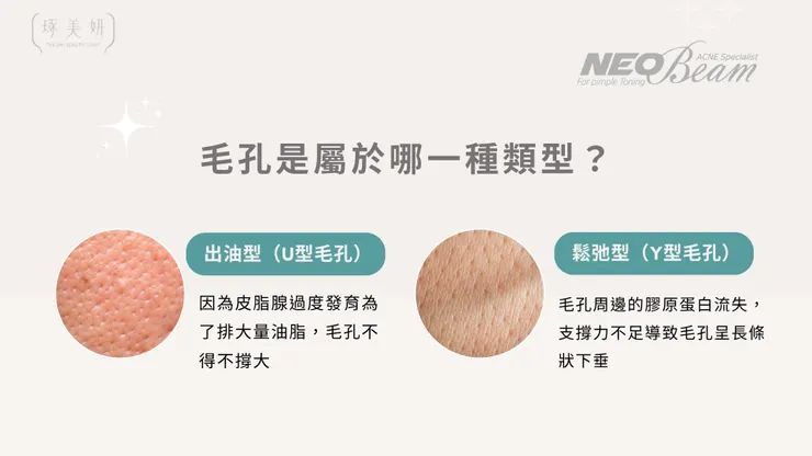 毛孔粗大沒救了?結合 Neobeam 清新光,打造「視覺無瑕」的縮毛孔計畫!