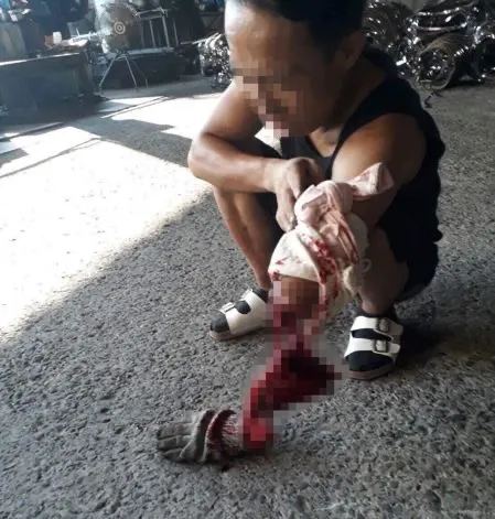 職災傷殘的移工（聯合報文章中截取）