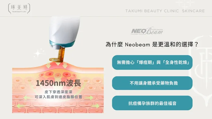 Neobeam 清新光 vs. 口服 A 酸：除了吃藥，你還有更溫和的控油選擇