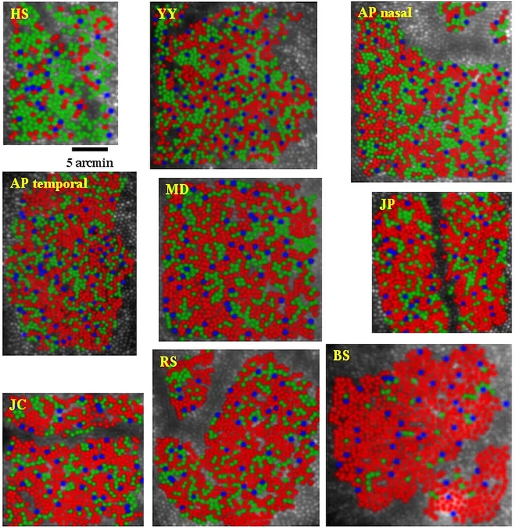 圖三、人眼視網膜中央凹 (fovea) 的紅藍綠三種視錐分布。圖中的9張顯微鏡照片來自不同的人，儘管他們的三種視錐分布差異很大，他們都是可以正常辨色的人類，沒有任何色盲或色弱的症狀。圖片來源: https://www.jneurosci.org/content/25/42/9669/tab-figures-data