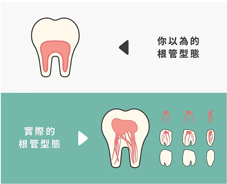 圖片來源:牙科小幫手