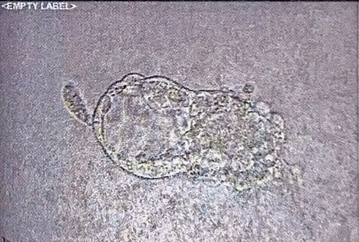 胚胎等級：HB GBB Day6