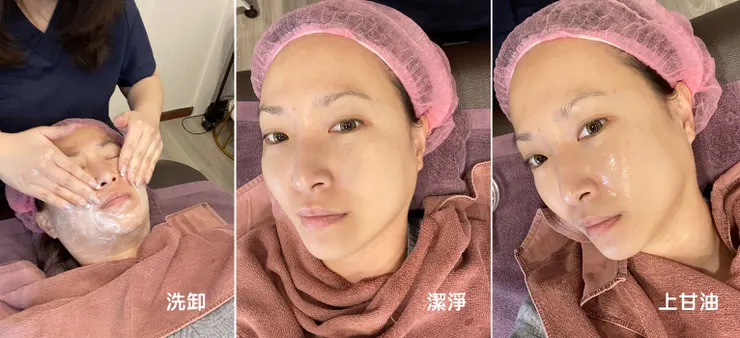 台北打雙下巴│ONDA超微波（昂達），台北醫美診所推薦【旭彤診所】
