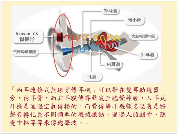 (圖片來源:骨傳導耳機漏音嚴重嗎?有沒有漏音小的骨傳導耳機)