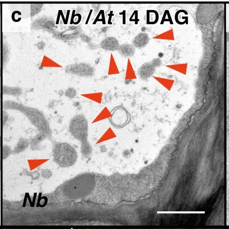煙草-阿拉伯芥嫁接處的自噬泡（紅色箭頭）。圖片取自Nature Communications