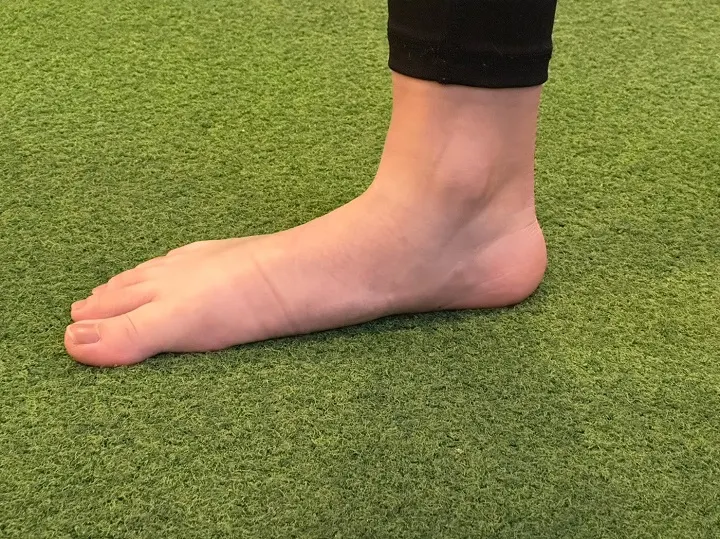 平時內傾的足弓