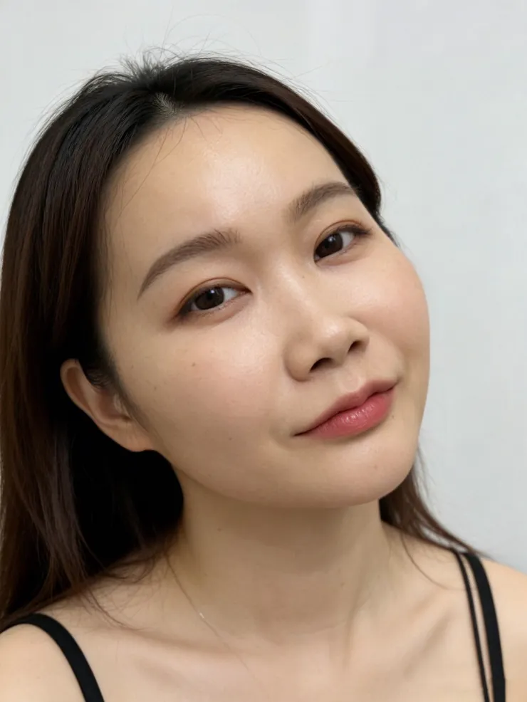 泰國曼谷醫美體驗|曼谷音波拉提推薦?泰國醫美諮詢流程與中文服務心得Best Friend Clinic