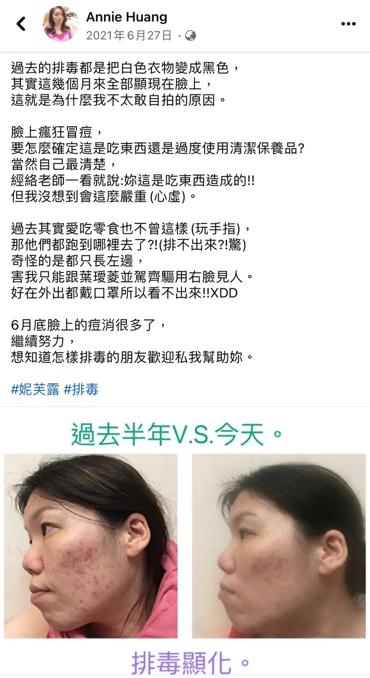 安妮姊姊的臉部排毒篇原文🔗