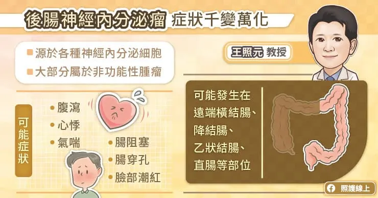 後腸神經內分泌瘤症狀千變萬化