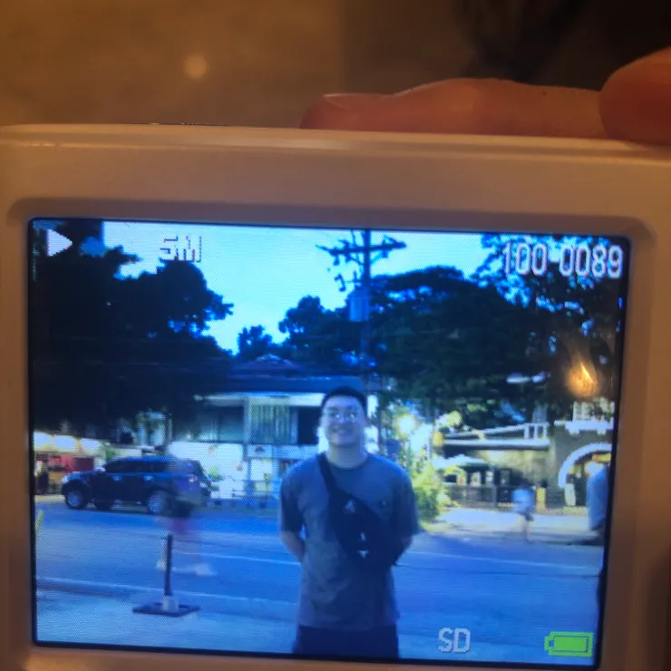 記錄劉鶴簽結束的時候會不會腫很多