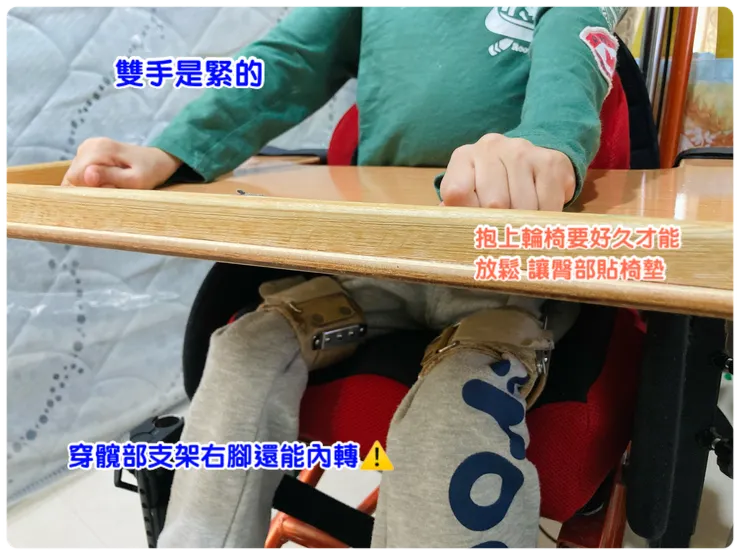 腦傷兒的日常一點都不簡單。
