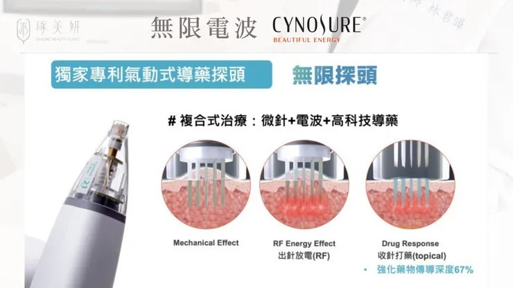 誰說水光感只能靠濾鏡？『無限電波(微針電波)Fusion Tip x 麗珠蘭』親手打造你的「Glass Skin」透亮肌