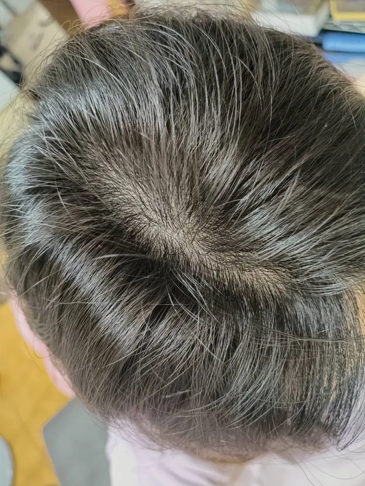 這是開始保養之前實拍。乾燥又灰白，黯淡無光......