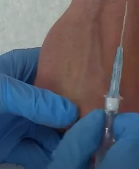 往手指頭的方向向下壓緊靜脈