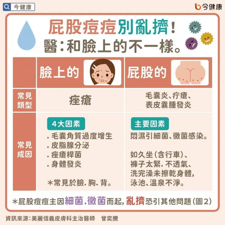 屁股與臉部痘痘的不同