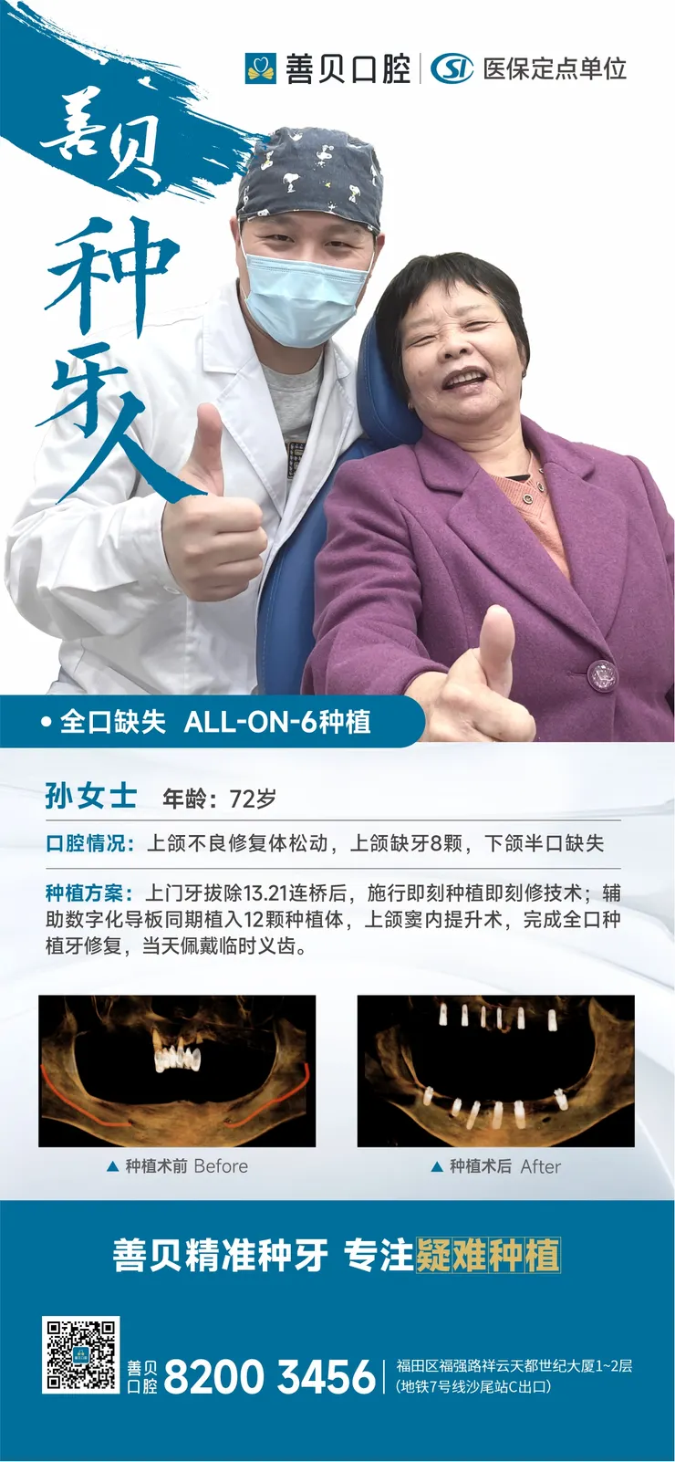 深圳善貝口腔种植病例展示