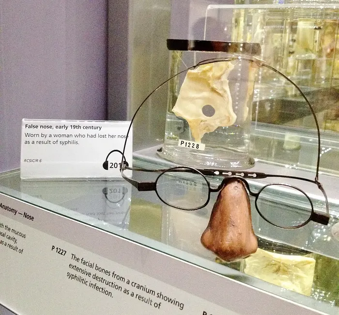 假鼻子眼鏡 / https://www.theculturemap.com/curiosities-hunterian-museum-london/