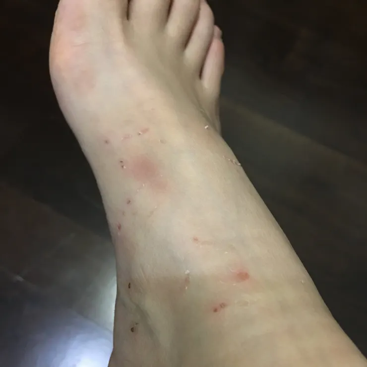 每天都有新傷痕