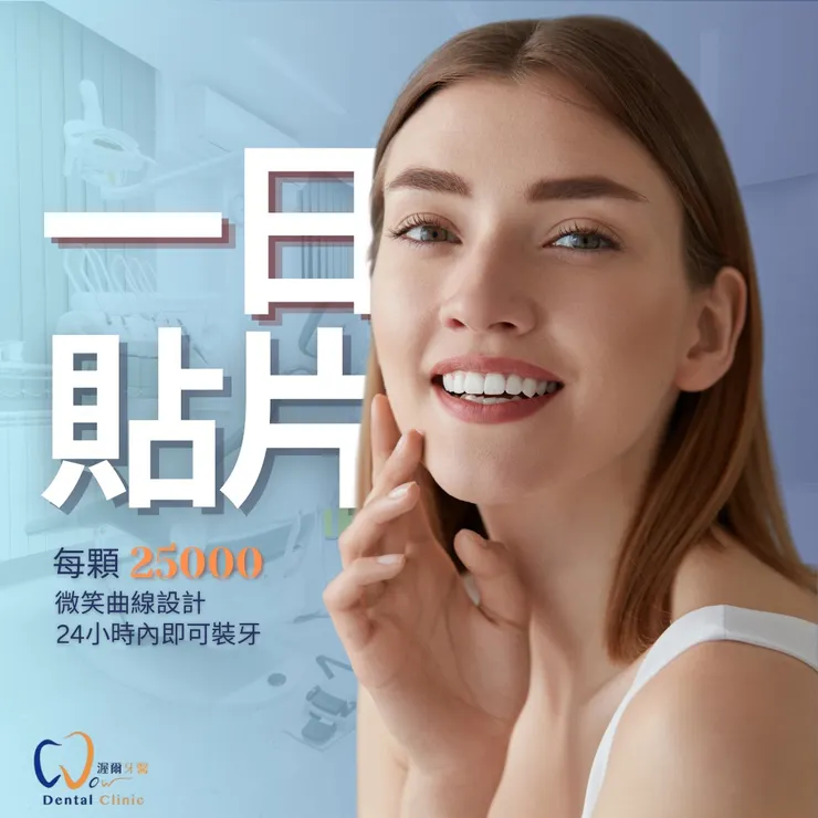 只要一天，讓你笑容大升級！渥爾牙醫診所的一日貼片打造明星級笑容！