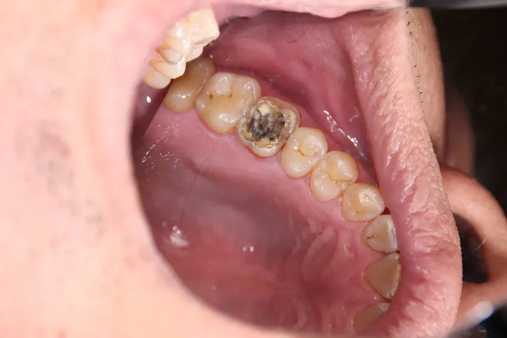 這是原圖，看不出裂痕