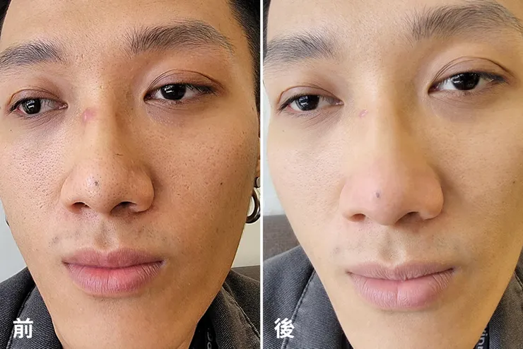 台南男生做臉推薦！男人的自我投資，告別油光滿面、痘痘粉刺，讓