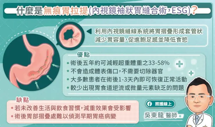 什麼是無痕胃拉提(內視鏡袖狀胃縫合術, ESG)