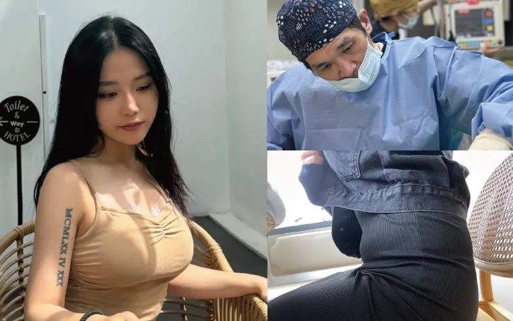 抽脂補胸 雅丰林口