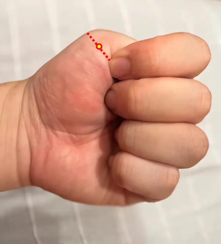 小節穴