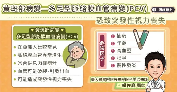 多足型脈絡膜血管病變視力喪失