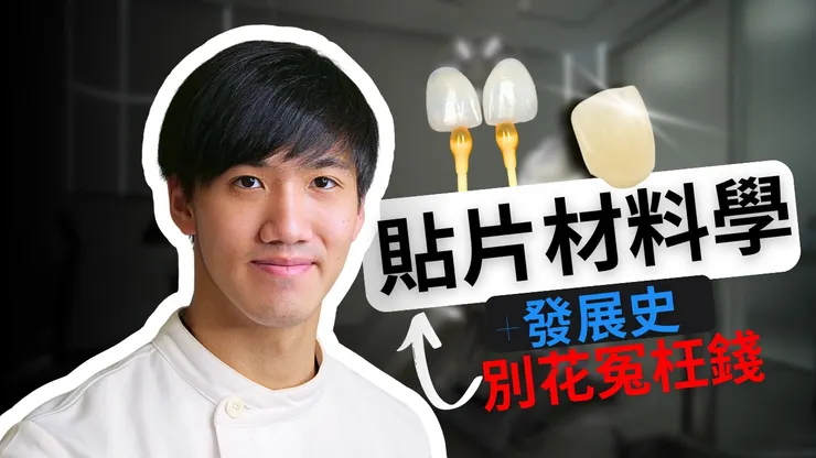 牙齒貼片(美白貼片)發展史與材質真相，從好萊塢假牙到現代微笑美學！