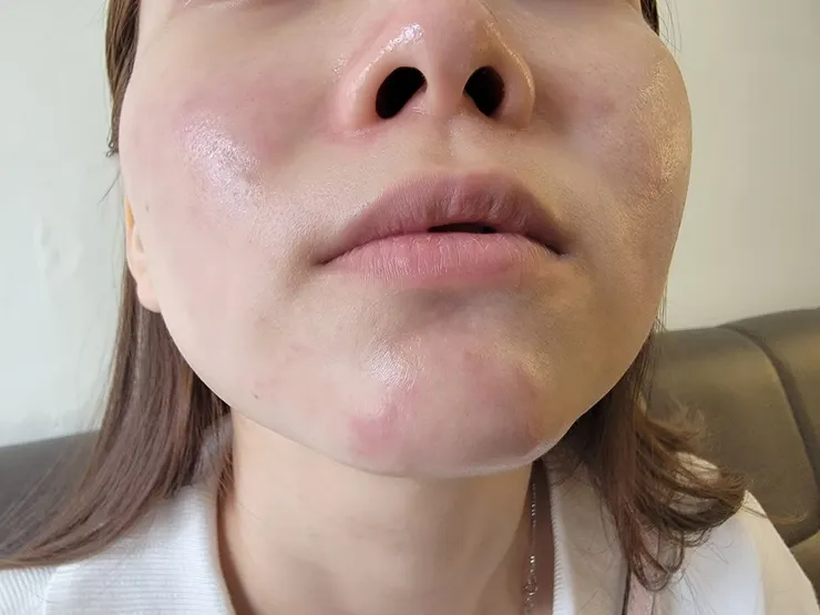 台南做臉推薦~聖誕跨年美美玩!水水臉蛋兒交給FILF小資美顏