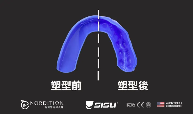SISU® 3D 運動牙套 ▂ 塑型前 塑型後