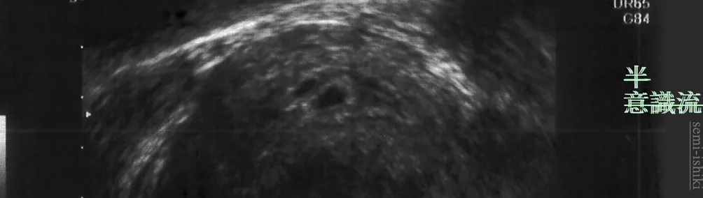 破日記｜白雪管的沙龍