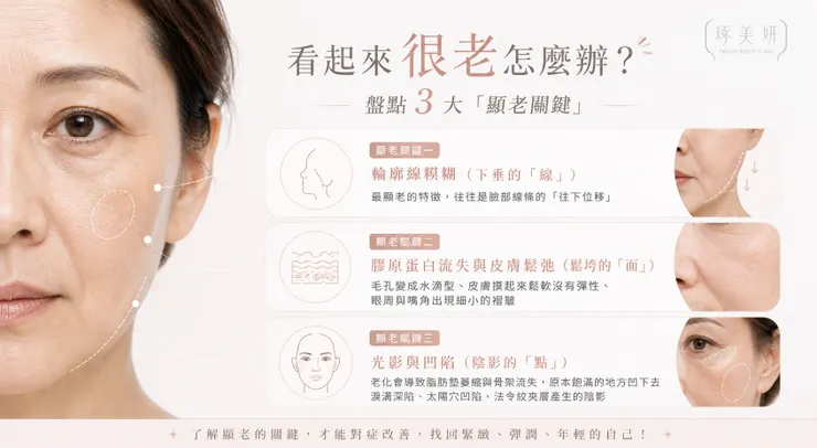 看起來很老怎麼辦？盤點3大「顯老關鍵」與「醫美」解決的方式！