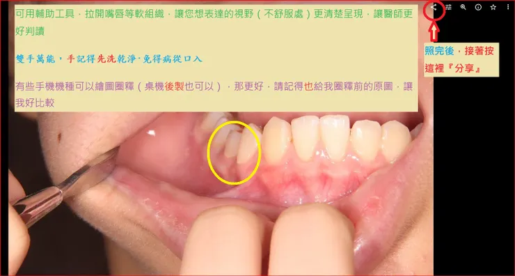 先拉開嘴唇，清空視野，照相，然後分享
