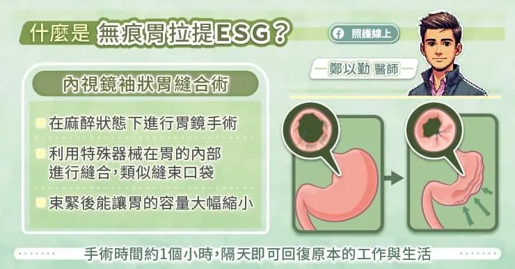 什麼是無痕胃拉提ESG？