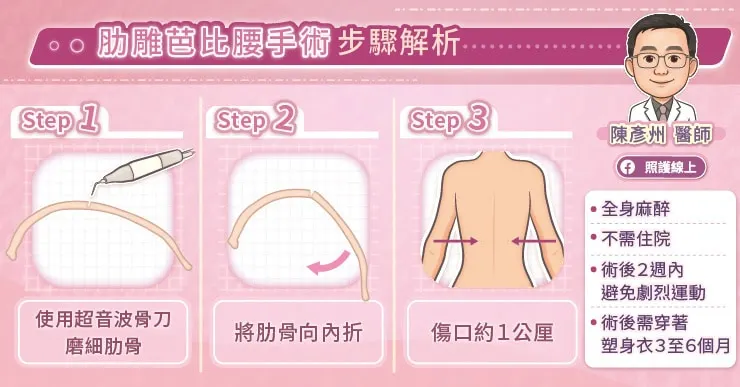 肋雕芭比腰手術步驟解析