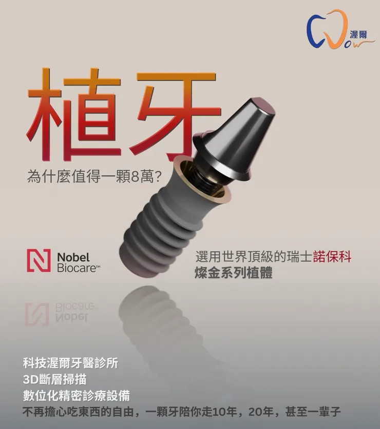 一顆植牙8萬元？為什麼渥爾牙醫選擇使用諾保科植體？