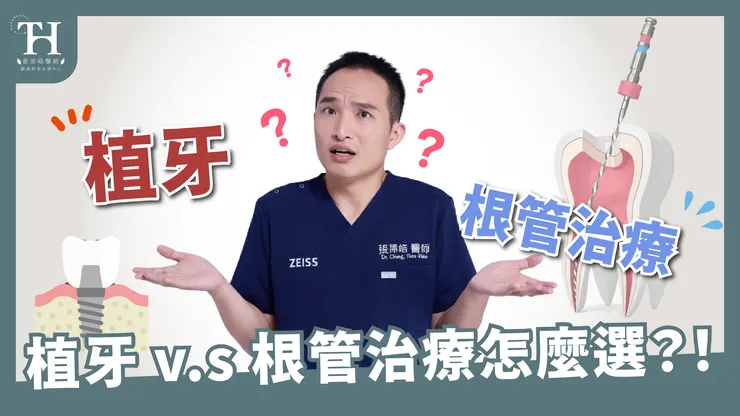 植牙、根管治療、抽神經