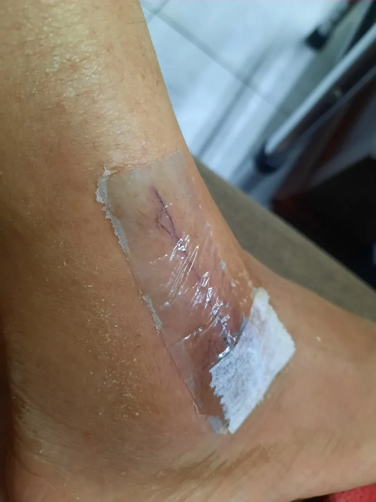 透明的,手很愛摳皮……