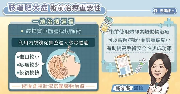 肢端肥大症術前治療重要性