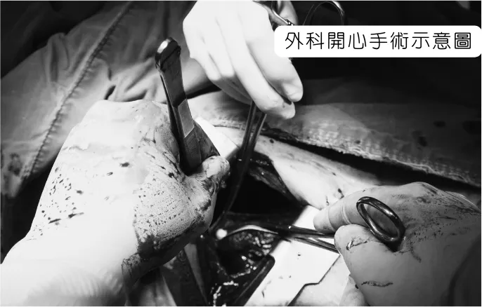 取材自Canva圖庫