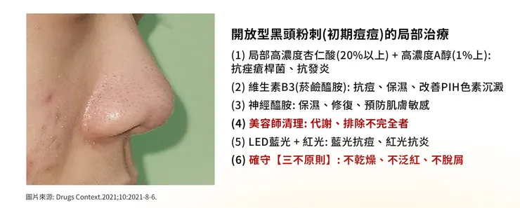悶痘長不停怎麼辦?