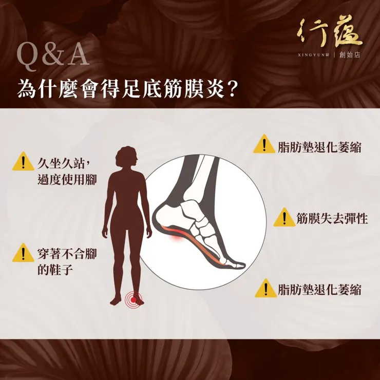 行蘊QA｜為什麼會得足底筋膜炎