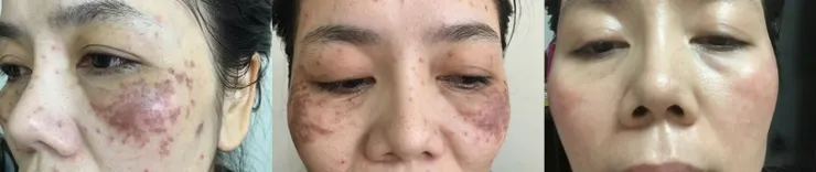 使用對的保養品跟觀念,讓你重新接納自己,想瞭解能與我聯繫