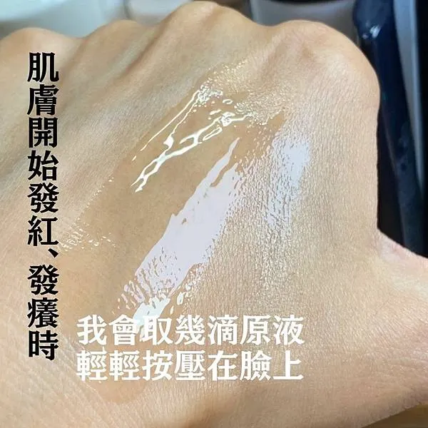 換季過敏擦什麼