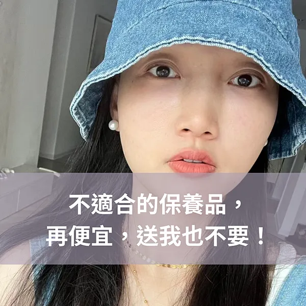 脂漏性皮膚炎保養推薦